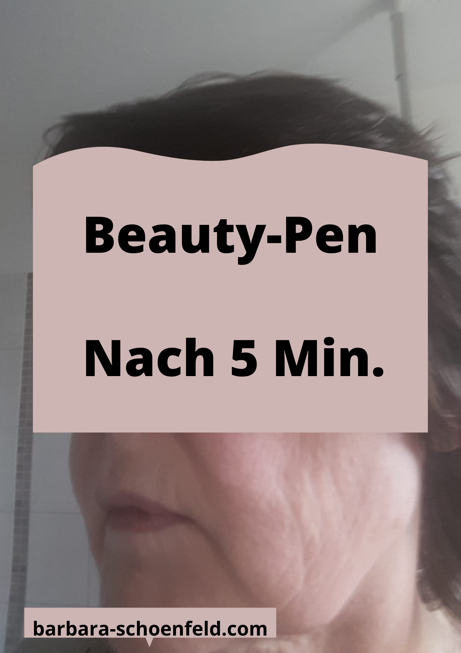 Juchheim-Beautypen-nachher1 Juchheim-Beautypen-nachher1
