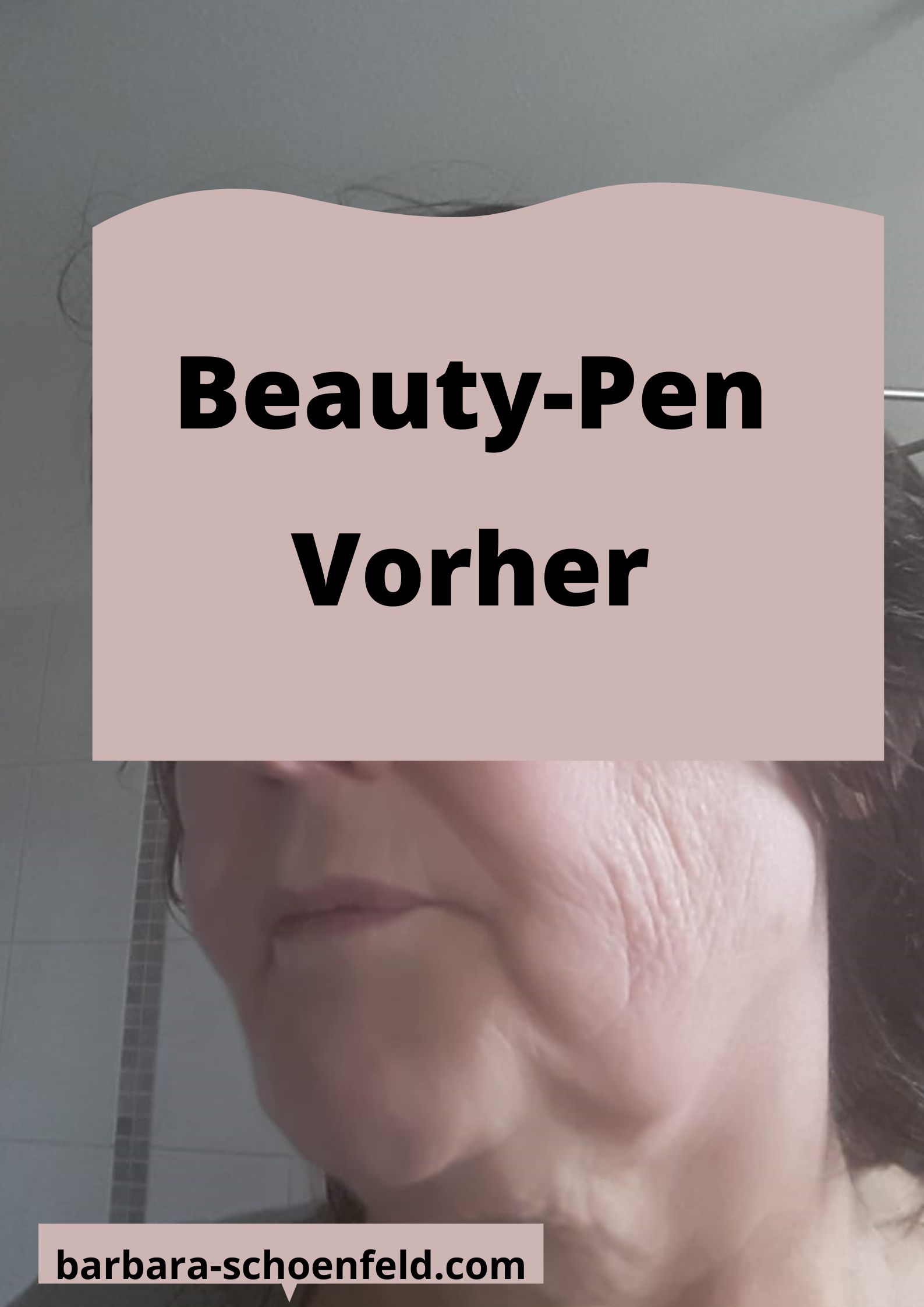 Juchheim-Beautypen-vorher1 Juchheim-Beautypen-vorher1