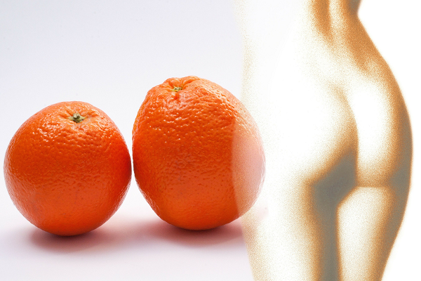 Juchheim-Cellulite Juchheim-Cellulite